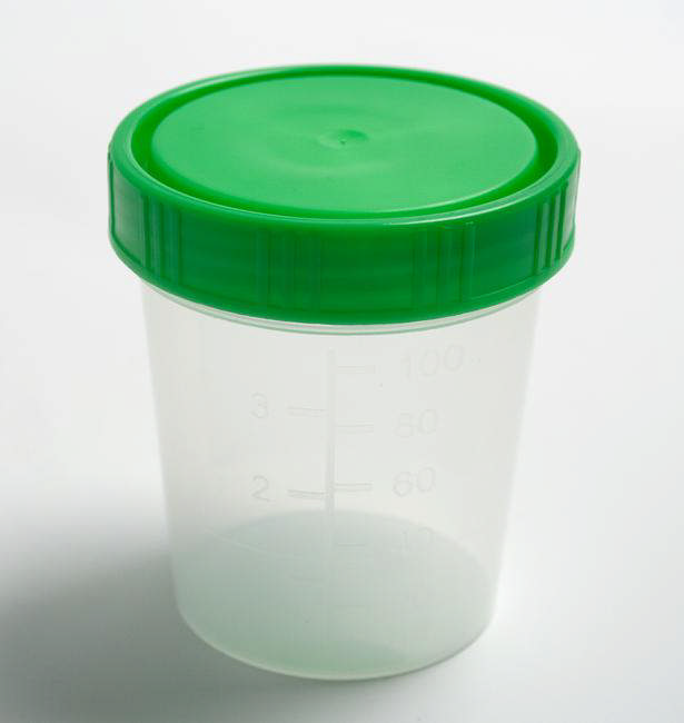 Urine Lid Green for Cup Screw Type